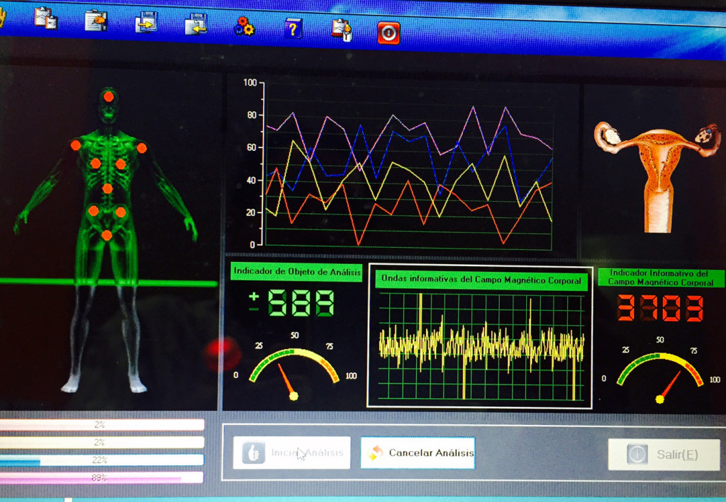 ESCANER DEL CUERPO: SISTEMA CUÁNTICO BIO-ELÉCTRICO SQX – CENTRO NATURISTA